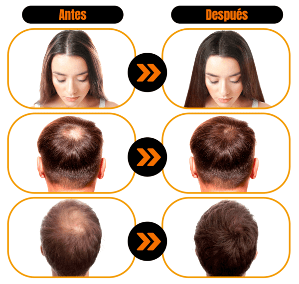 antes y despues cubuka